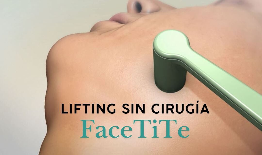 Lifting sin cirugía en Pozuelo