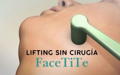 Lifting sin cirugía en Pozuelo